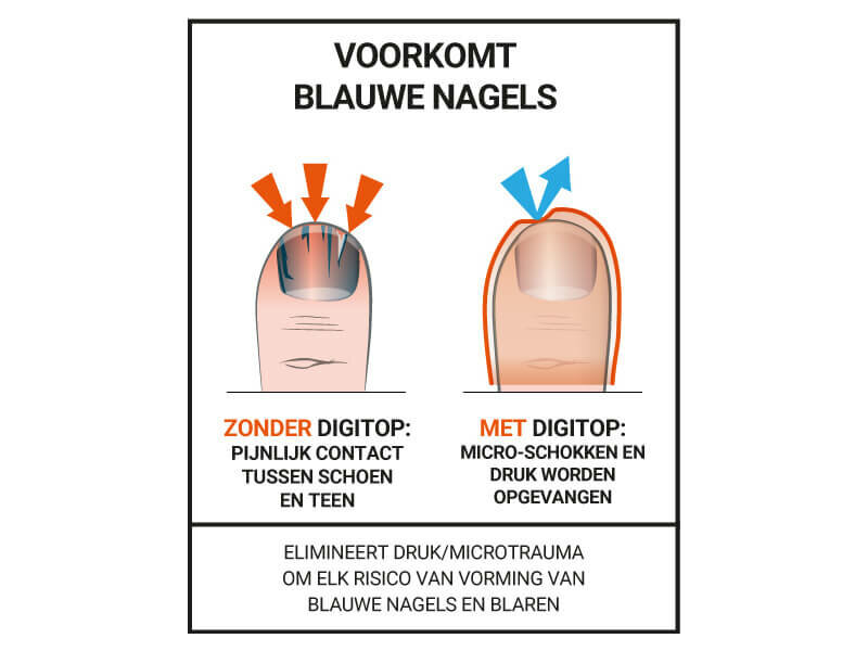 Uitleg epitact sport nagelbeschermer