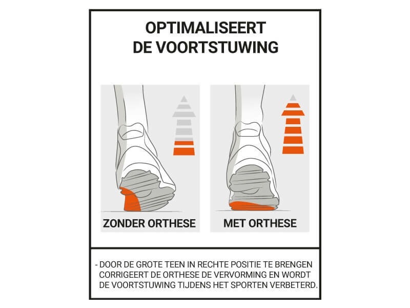 Uitleg werking epitact sport hallux valgus