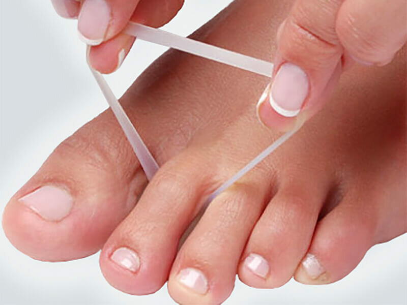 Hamerteenkussen linkervoet tweede teen flexibele lus van sterk gel materiaal