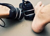 Overtollig eelt, kloven en droge voeten Overtollig eelt, kloven en droge voeten