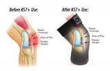 KS7+ kniebandage jumper's knee